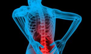 Healthcare Clinicians In Sydney Prefer Data Analytics To Cure Back Pain
