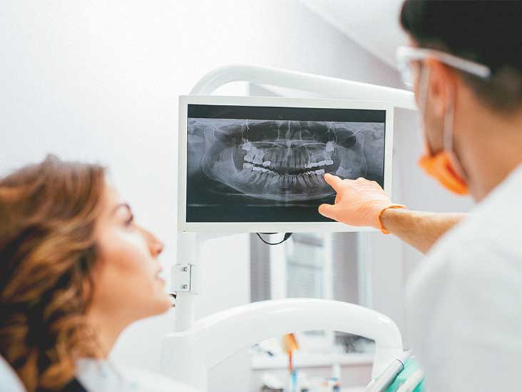 Dental Imaging Devices Market