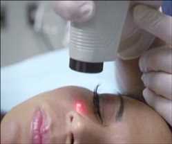 Aesthetic/Cosmetic Lasers