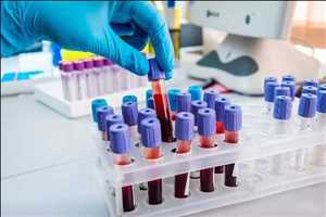 Clinical Microbiological Test Market