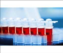 Global Cord Blood Banking Services Market 