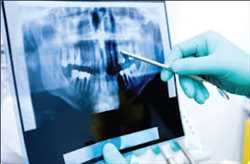 Global Dental Imaging Market 