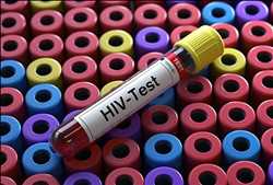 Global Human Immunodeficiency Virus HIV Rapid Test Kits Market 
