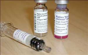 Human Rabies Immunoglobulin  Market