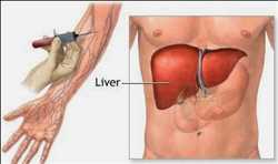 Global Liver Function Tests Market 
