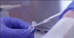 Global Plasmid DNA Manufacturing Market 