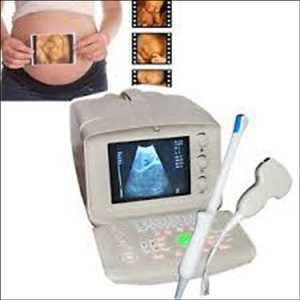 Global Diagnostic Ultrasound Scanner Market Growth