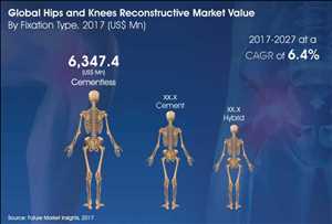 Global Hips And Knees-Reconstructives Market Demand