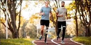 Global Lower Extremity Orthopedic Prosthetics Market Industry