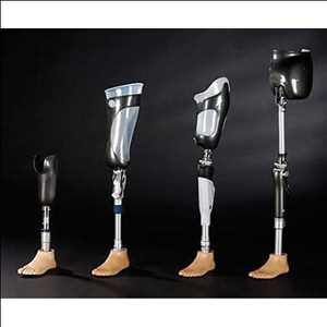 Global Lower Extremity Prosthetics Market Insights