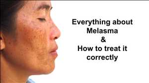 Global Melasma Treatments Market Insights