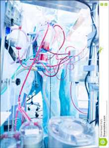 Artificial Heart Lung Machines Market
