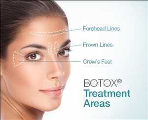 Botox Market