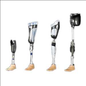 Limb Prosthetics Market