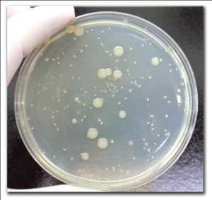 Microbial Testing Market