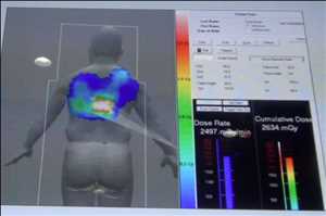 Radiation Dose Monitoring Market