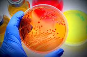 Microbiology Culture