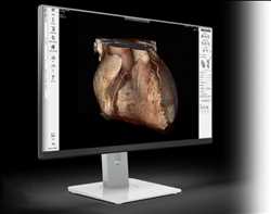 Structural Heart Imaging