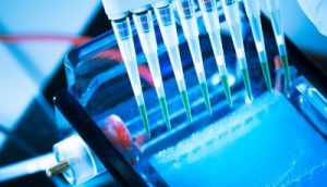 Global In Vitro Diagnostics (IVD) Market