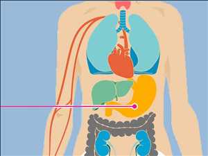 Global Chemotherapy Market Analysis