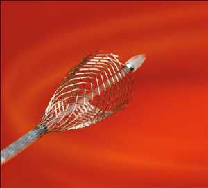 Global Enteral Stents Market Growth