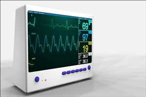 Electrocardiogram Equipment Market