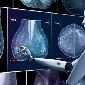 Breast Cancer Detection