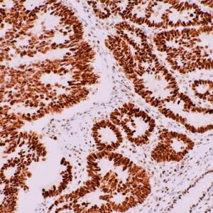 Immunohistochemistry (IHC)