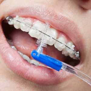 Interdental Brush