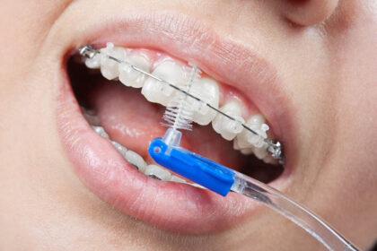 Interdental Brush