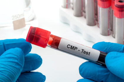 Comprehensive Metabolic Panel Testing