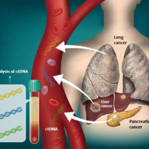 Lung Cancer Liquid Biopsy